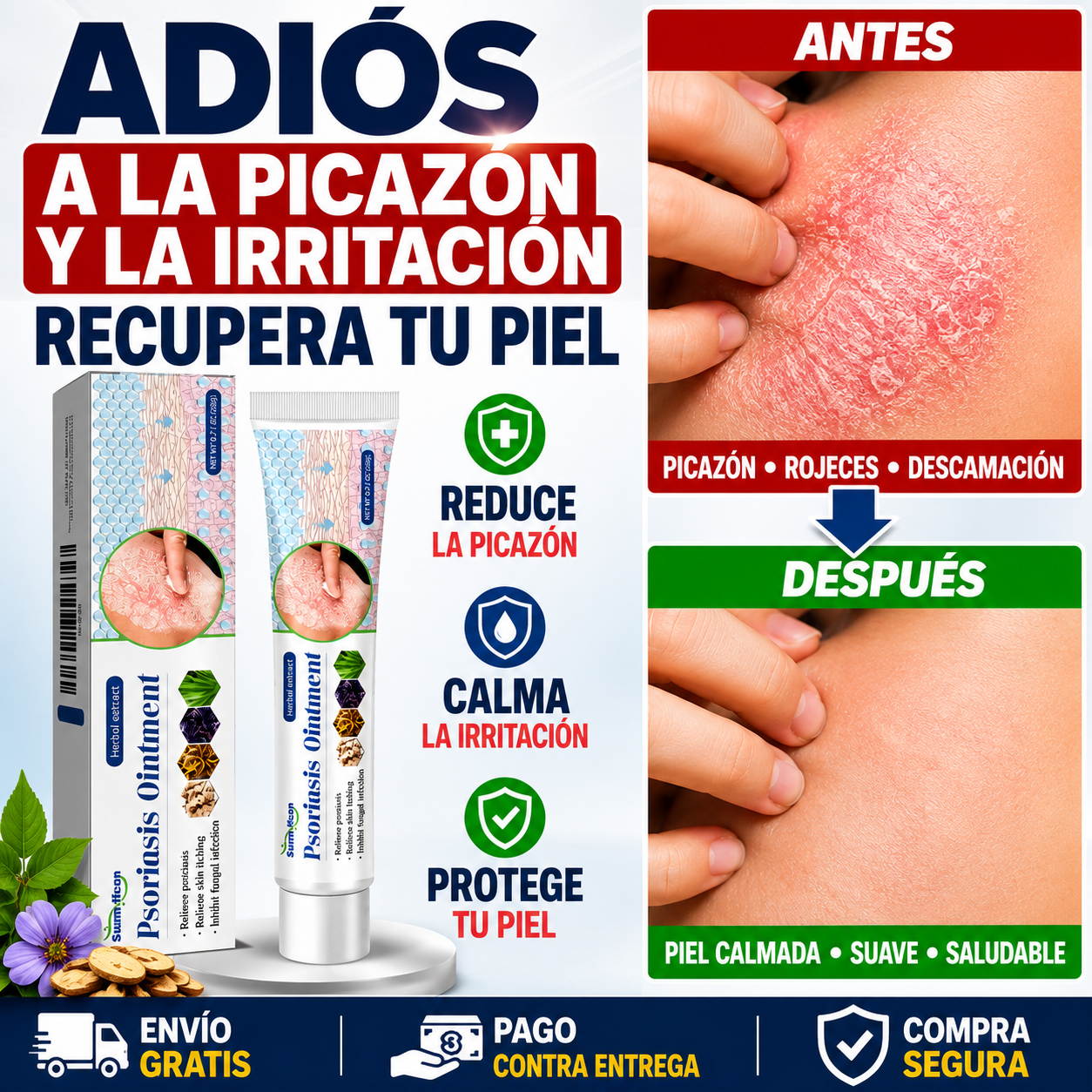 Crema para Aliviar la Picazón e Irritación de la Piel