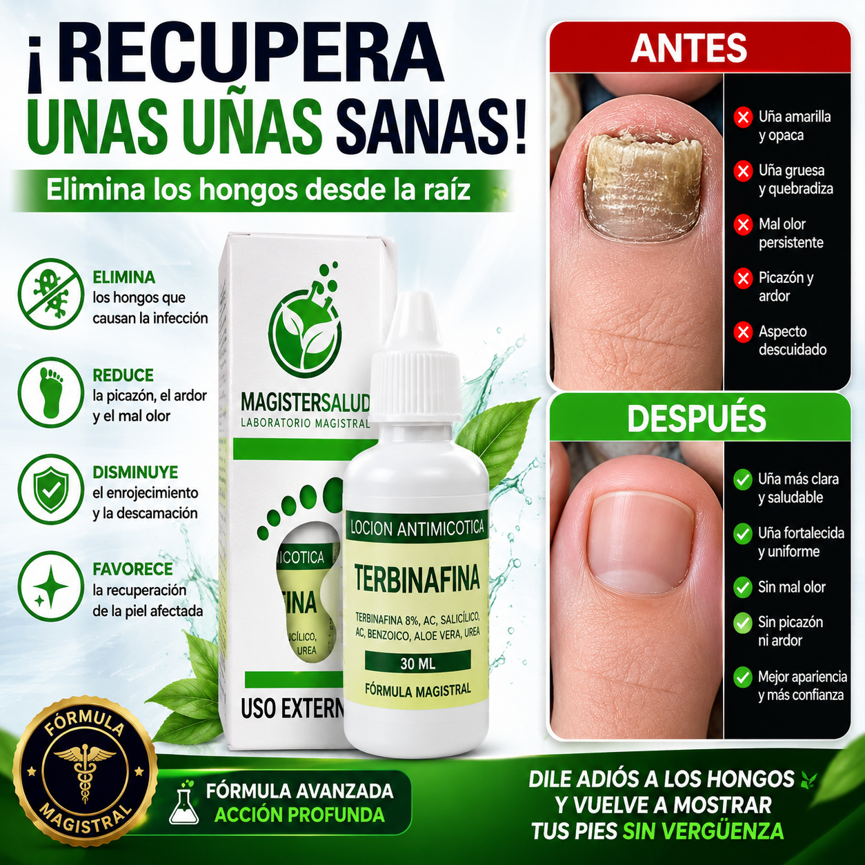 TERBINAFINA EN GOTAS - 30 ML